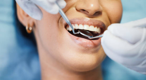 Best Walk-In Emergency Dental Services in Nacogdoches, TX